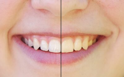 How to Avoid Staining Teeth When Drinking Coffee