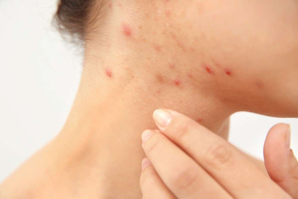 root skin problems cure secrets