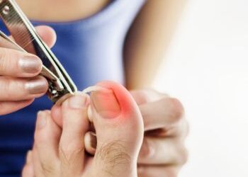 How to Get Rid Of an Ingrown Toenail Overnight